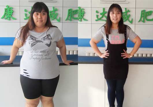 260斤女孩冒冒减肥前后对比照