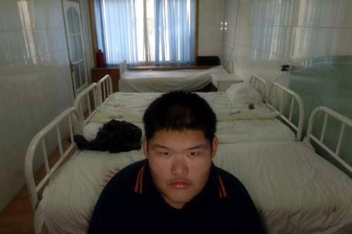 曾经的中国第一胖 现在啥模样9