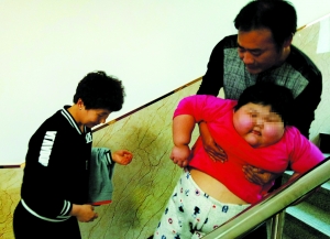 7岁娃,体重75公斤，出门坐轮椅