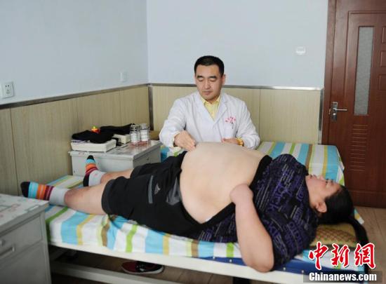 针灸减肥适合哪些人