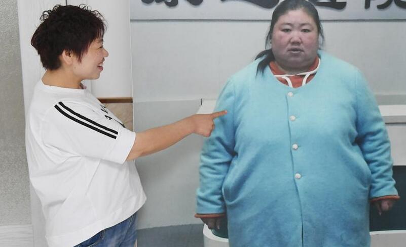 女子在长春康达减肥一年瘦了242斤 重获爱情2