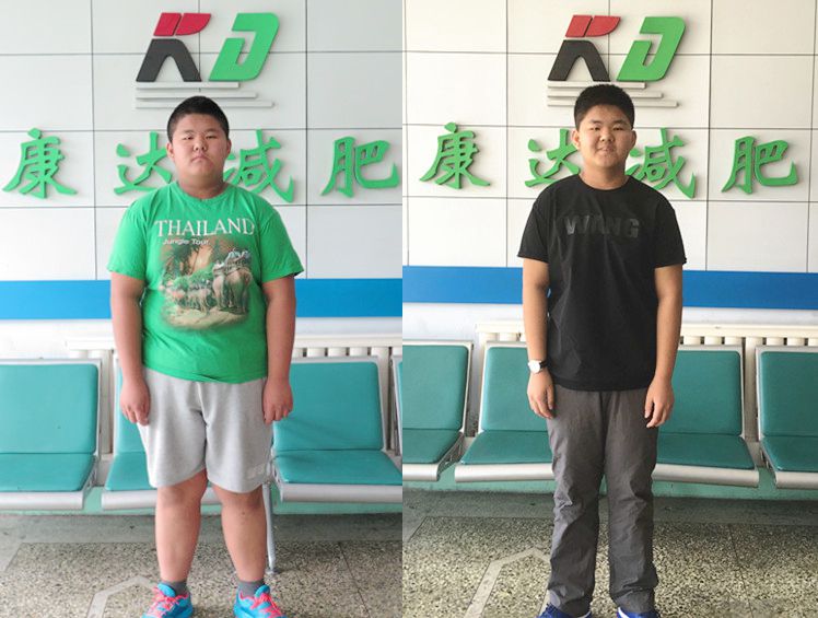 13岁男孩重达250斤 来长春康达减肥7个月瘦了77斤3