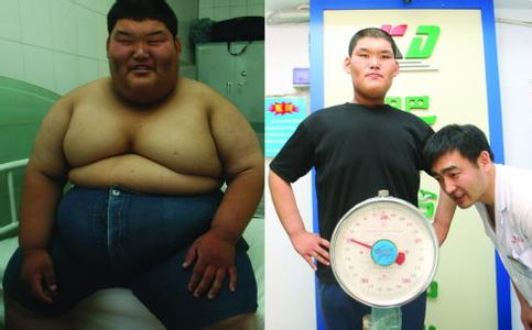 “中国第一胖”朱磊一年减掉122.5公斤jpg