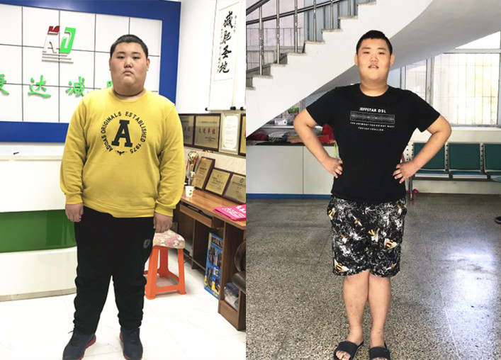 301斤男孩张旸哲长春减肥 瘦了100斤 
