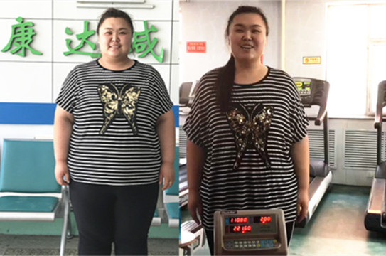 长春320斤胖女减肥3个月瘦了近99斤2