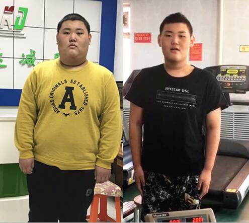 辽宁16岁男孩赴长春减肥减113斤