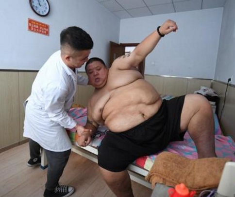 河南480斤胖男到长春减肥 希望恢复健康照顾家人 (2)