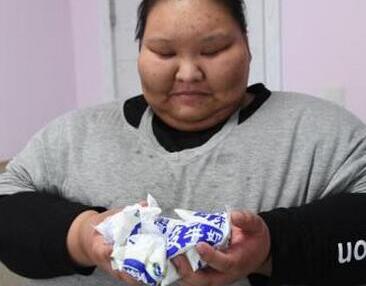 易胖体质怎样减肥?