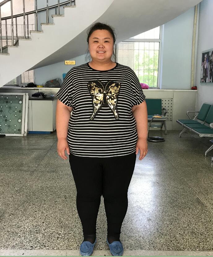 冯丹丹长春减肥5个月瘦身135斤