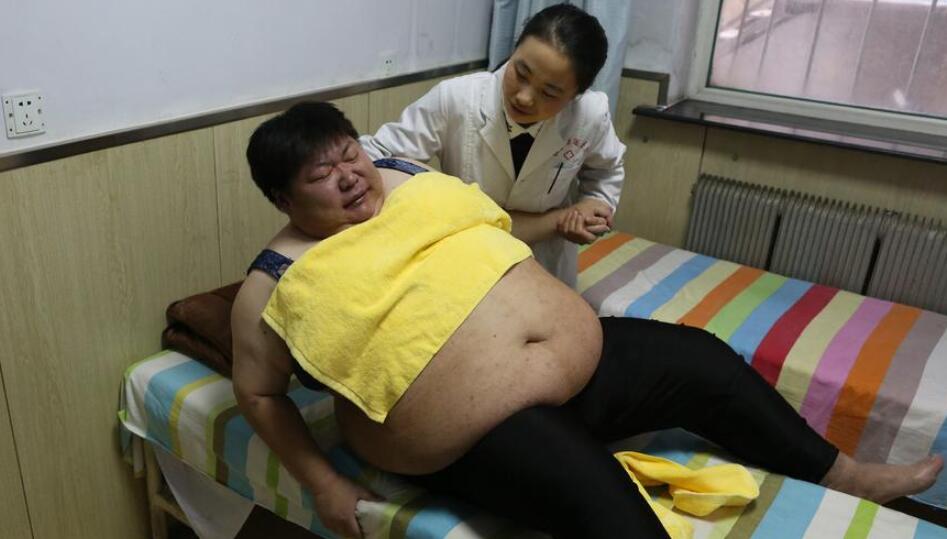 32岁女子体重361斤 减肥3个月甩肉106斤7