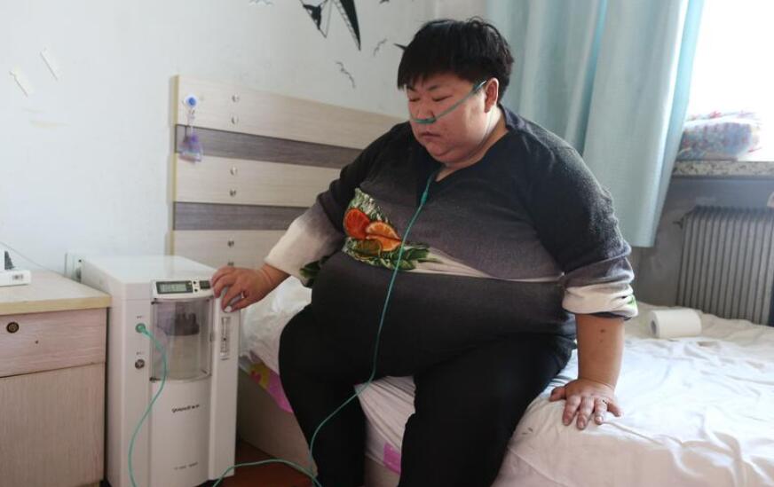 32岁女子体重361斤 减肥3个月甩肉106斤4