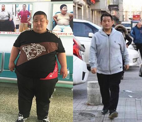 “河北第一胖”刘尚涛长春减肥321斤3