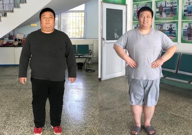 肥胖金牌销售刘小冬减肥3个月怒瘦90斤