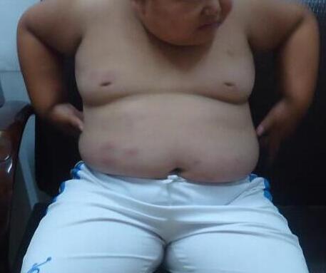 为什么如今肥胖的孩子越来越多?
