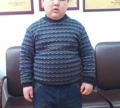 孩子肥胖比偏瘦更可怕jpg