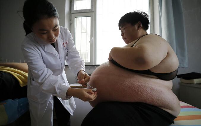 你瘦不下来的原因汇总2