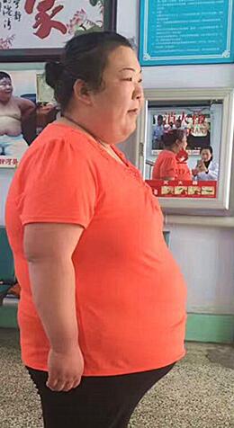 节食减肥之后容易导致便秘?