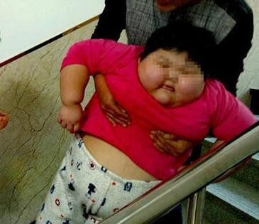 儿童过多摄入“五毛食品”或致肥胖早熟