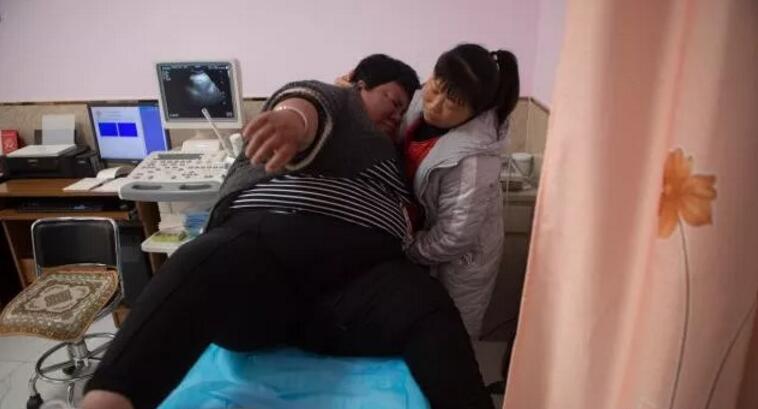 安徽杨茹在长春减肥俩月掉60多斤6
