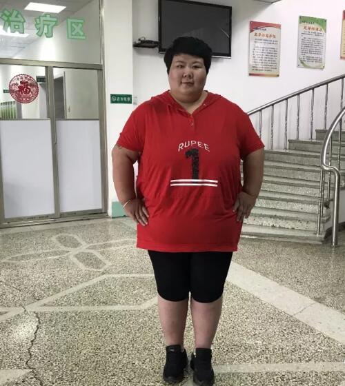 安徽杨茹在长春减肥俩月掉60多斤10
