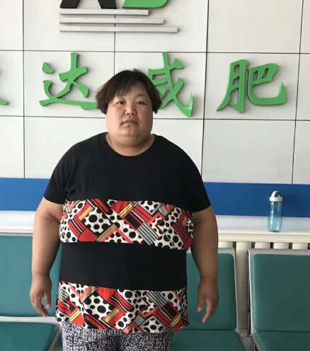 女性更年期为什么会发胖？