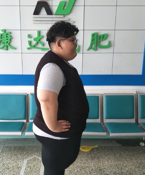 变胖先胖哪里?为什么呢?