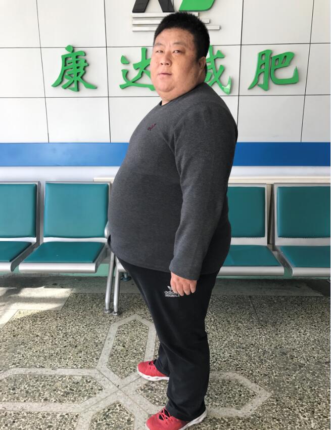 300多斤胖男为挽救婚姻到长春康达减肥 4