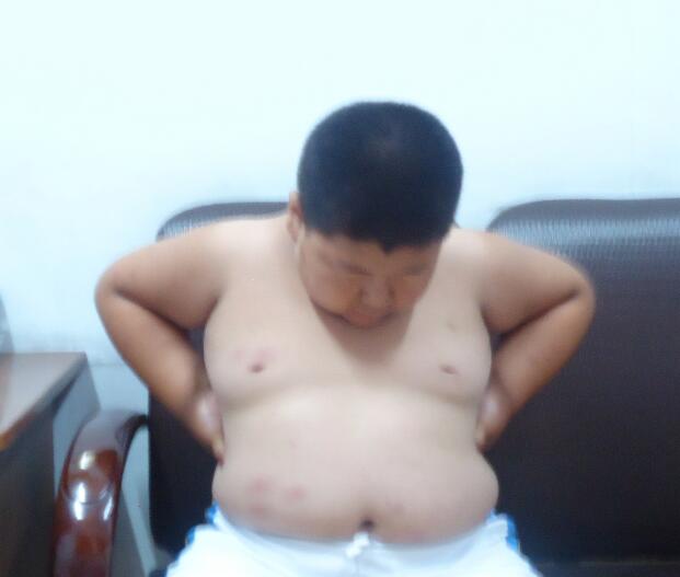 细数肚子长肉的原因