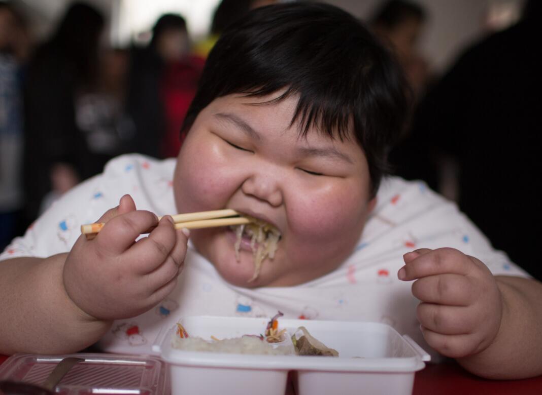 儿童肥胖的危害，远远超过了你的想象_澎湃号·湃客_澎湃新闻-The Paper