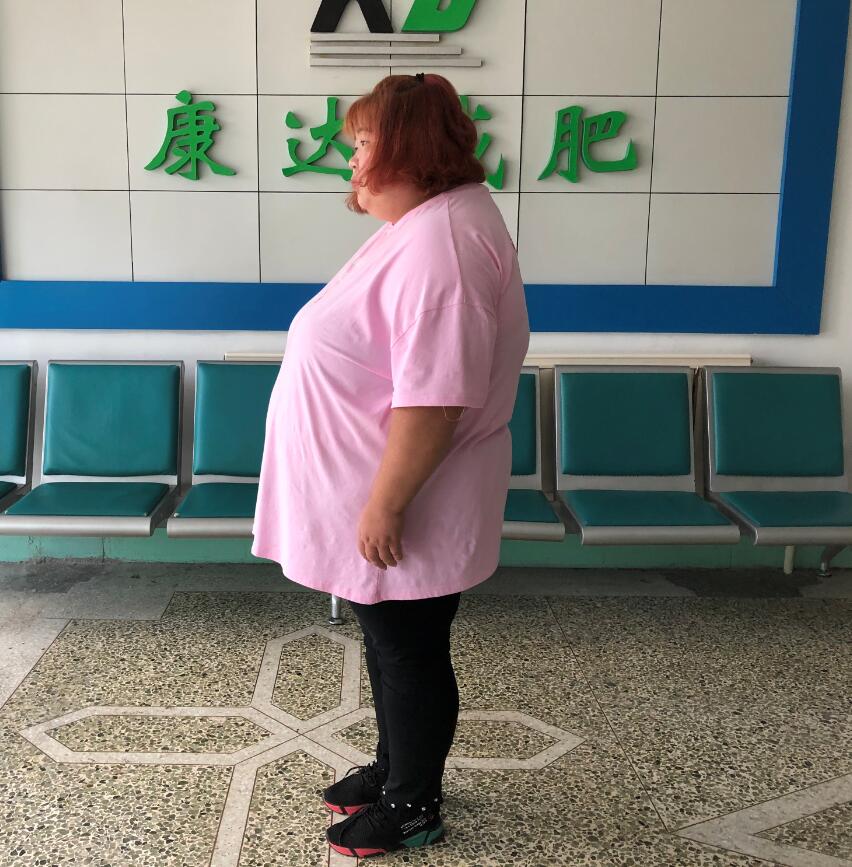 江苏胖妹到长春康达医院减肥，一个月瘦了40斤1
