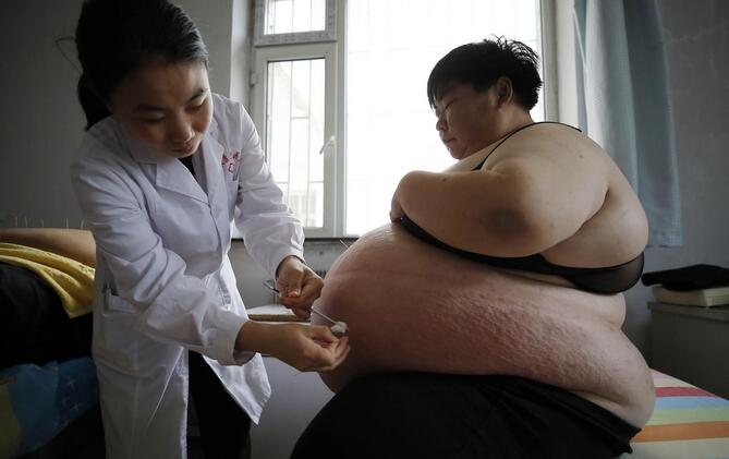 莱州胖女体重361斤到长春减肥 因胖生命遭到多次威胁4