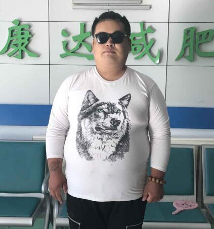 男人肚子大怎么减比较快