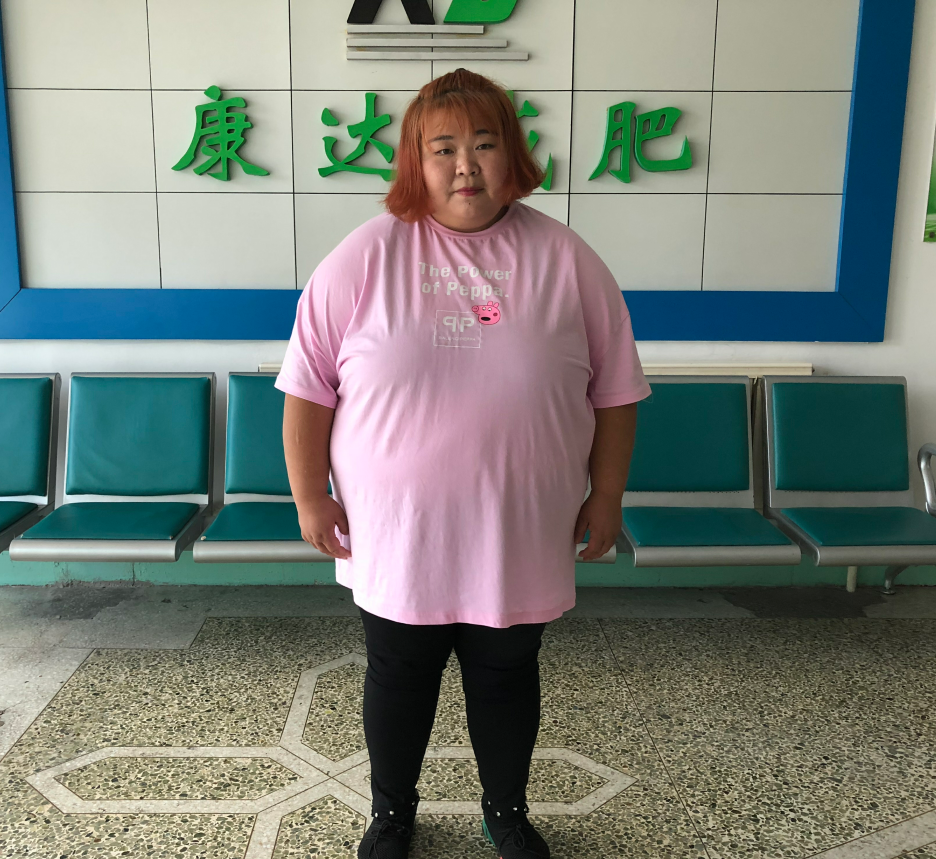 在长春康达医院减肥五个月,张丹娜狂瘦123斤1