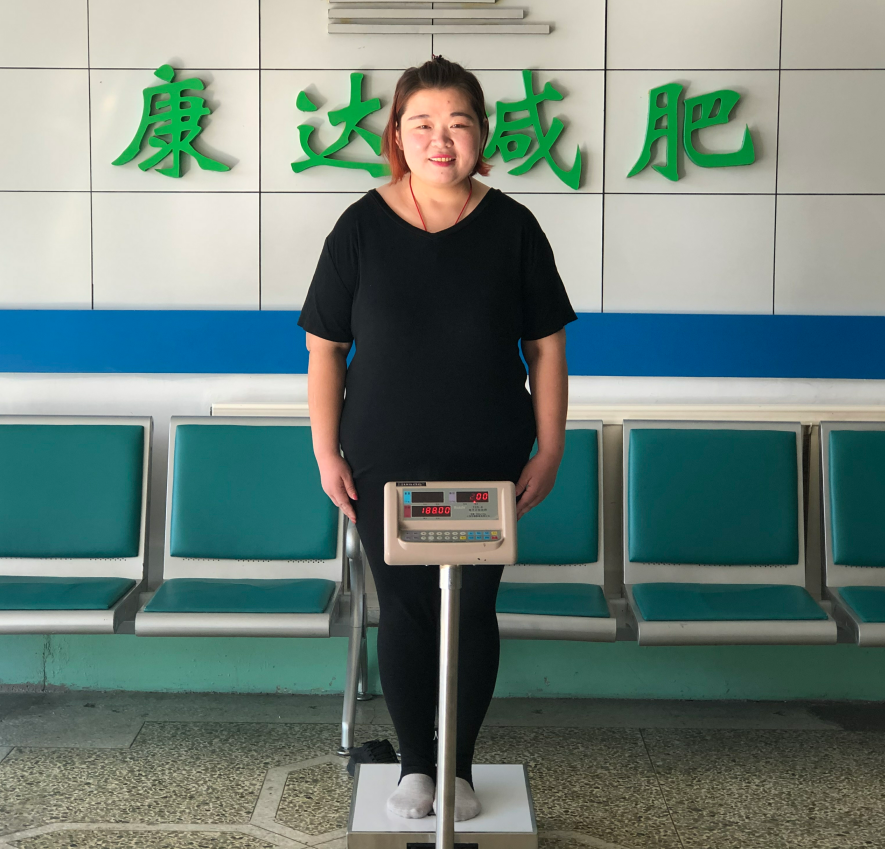 在长春康达医院减肥五个月,张丹娜狂瘦123斤2