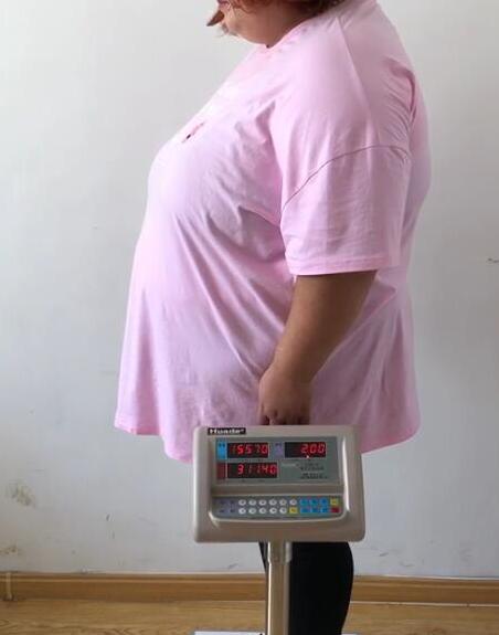 减肥后又反弹的女性患心脏病的风险增加