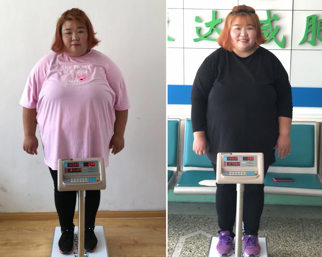 210斤的“中国最美女胖子”狠花3个月瘦72斤竟美成金喜善！_时尚_环球网