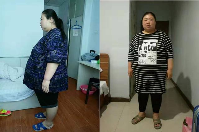 女子遭丈夫背叛体重长到380斤在长春成功减肥2