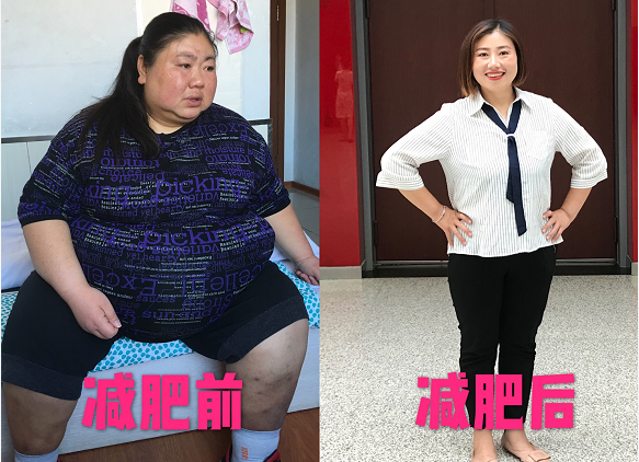 单身妈妈因心理型肥胖体重暴涨 今减掉240斤重获新生1