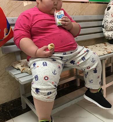 婴儿肥胖为日后健康埋下隐患,该如何预防婴儿肥胖