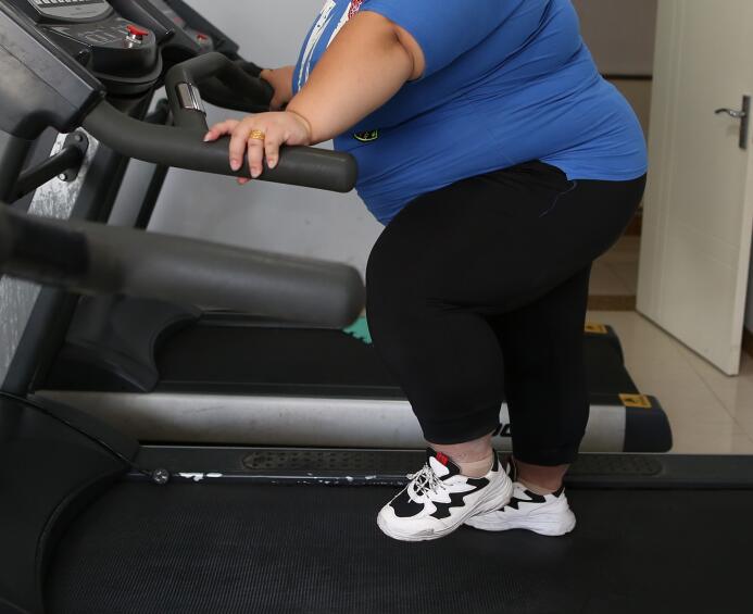 肥胖者跑步更要注重安全