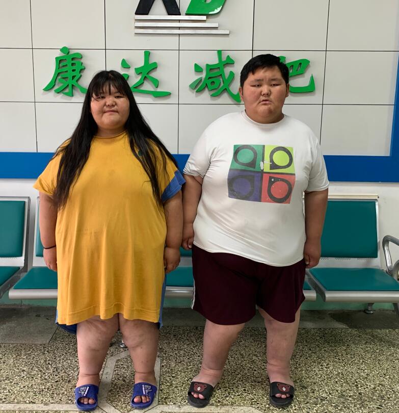 姐弟疑似肥胖遗传被吉林减肥医院援助9
