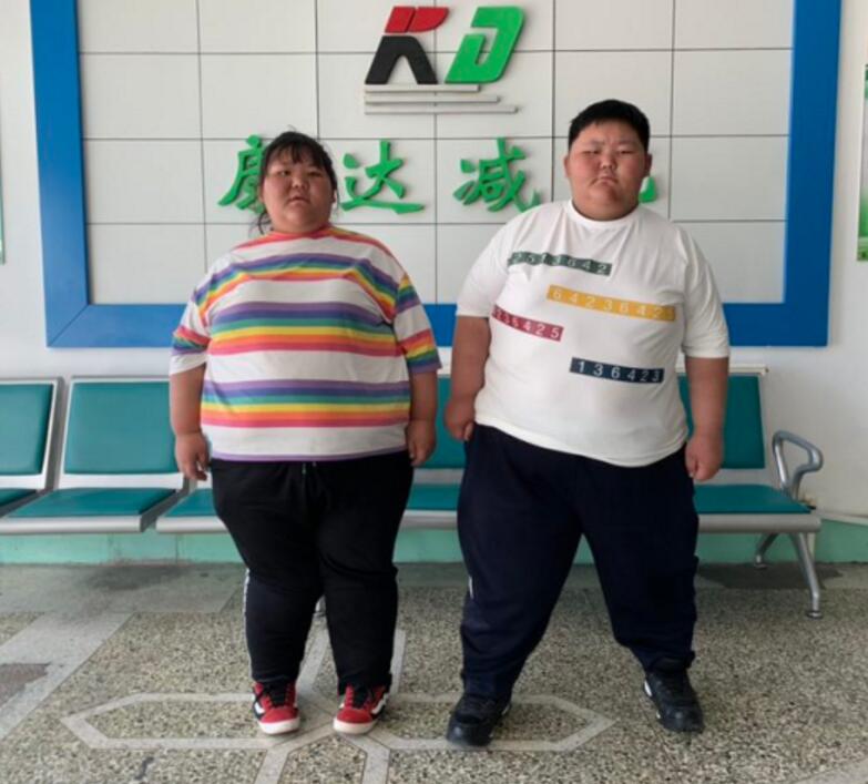 姐弟疑似肥胖遗传被吉林减肥医院援助1