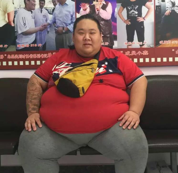 网红李超在长春康达医院减重145斤1