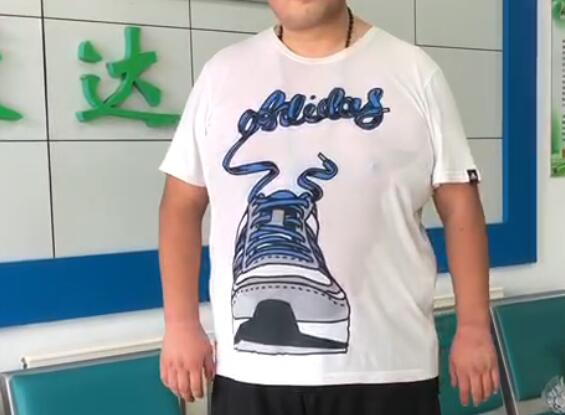 腹部肥胖少吃能瘦下来吗?【长春康达减肥】