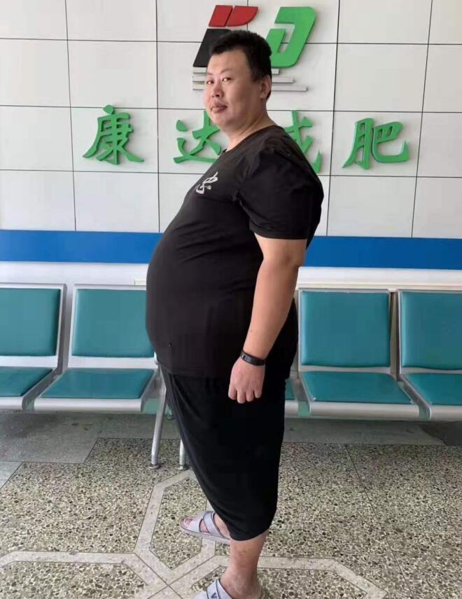 在长春康达减重110.6斤崔磊回家过年1