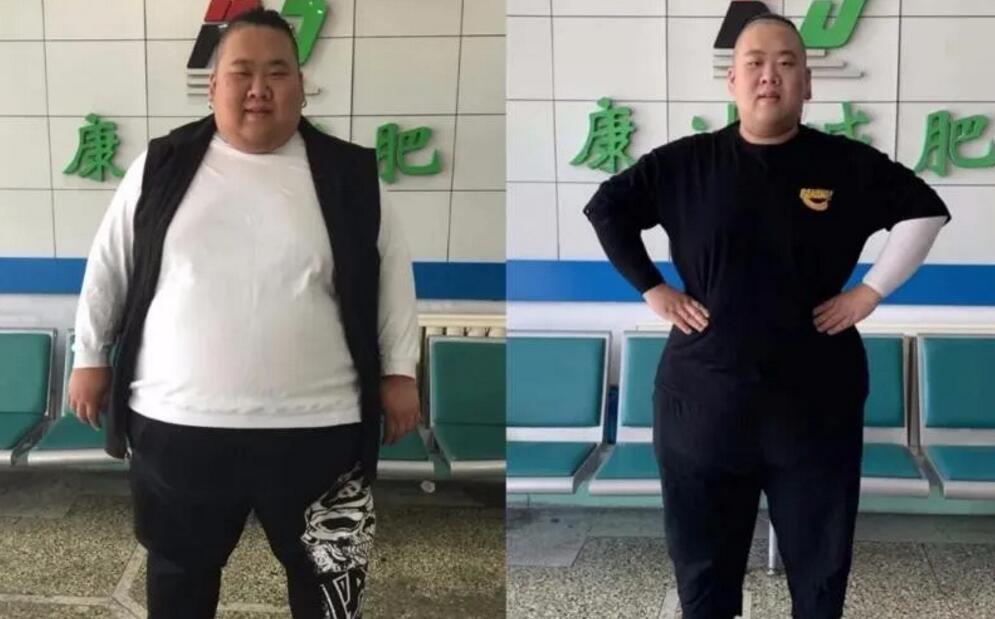 东北最胖小伙在康达减肥200余斤9