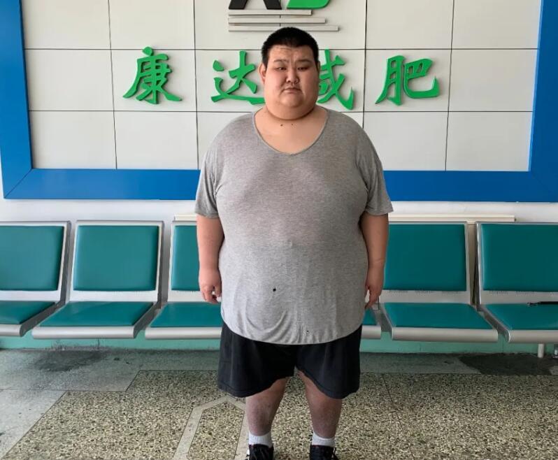 巨胖男青年在长春康达减肥四个月狂减110余斤13