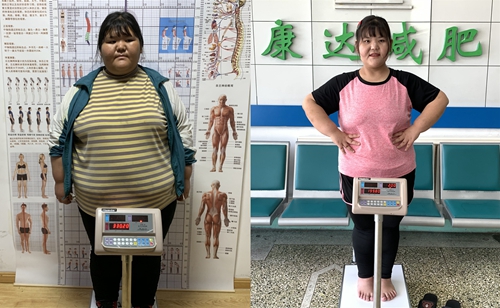 330斤大一女生在长春康达减肥130斤1