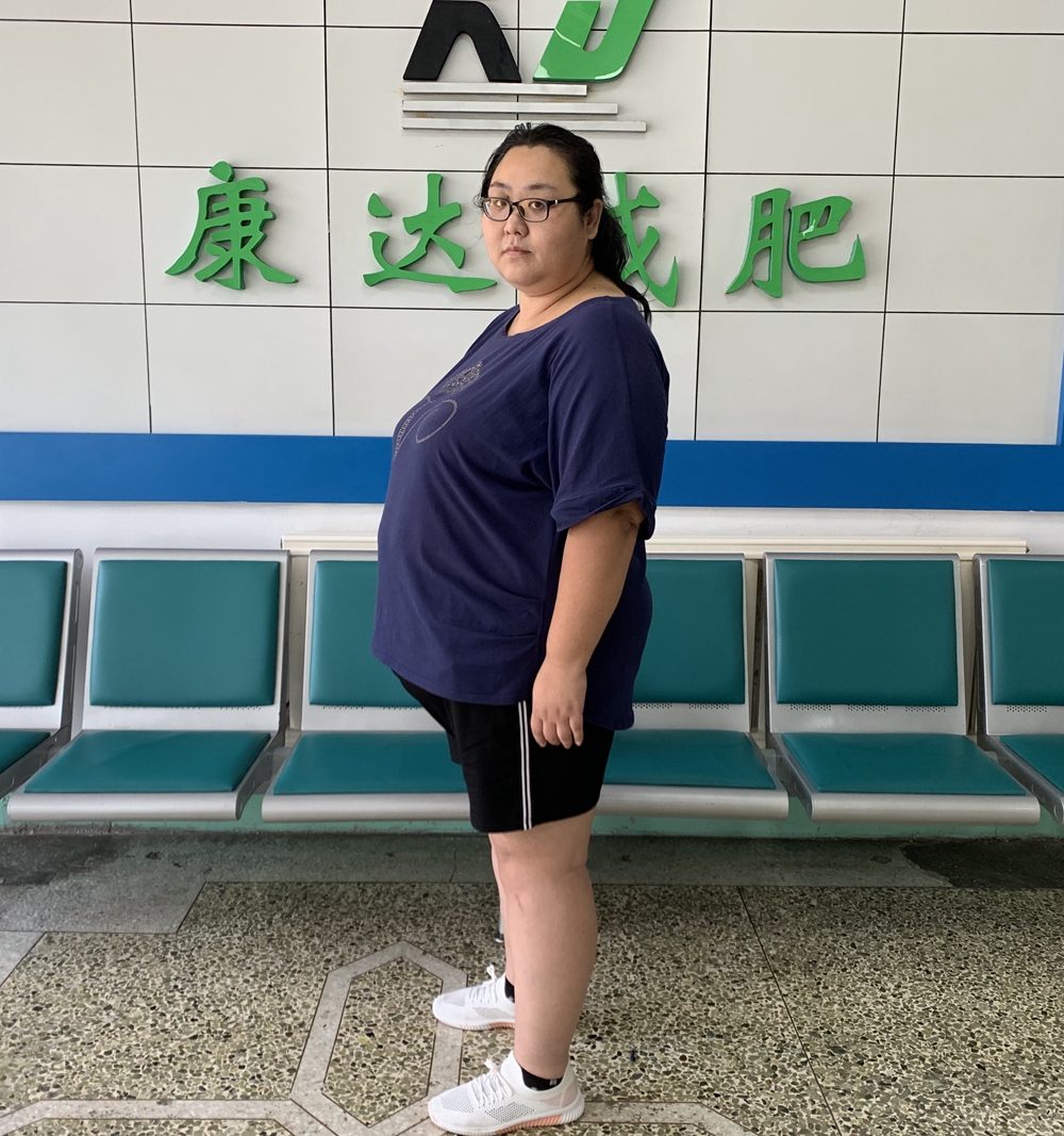 30+的她在康达减肥一个月瘦31斤1