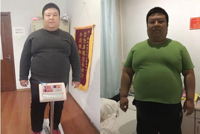 刘小冬在长春康达减肥医院瘦179斤3